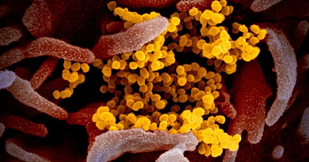 Calor y Coronavirus