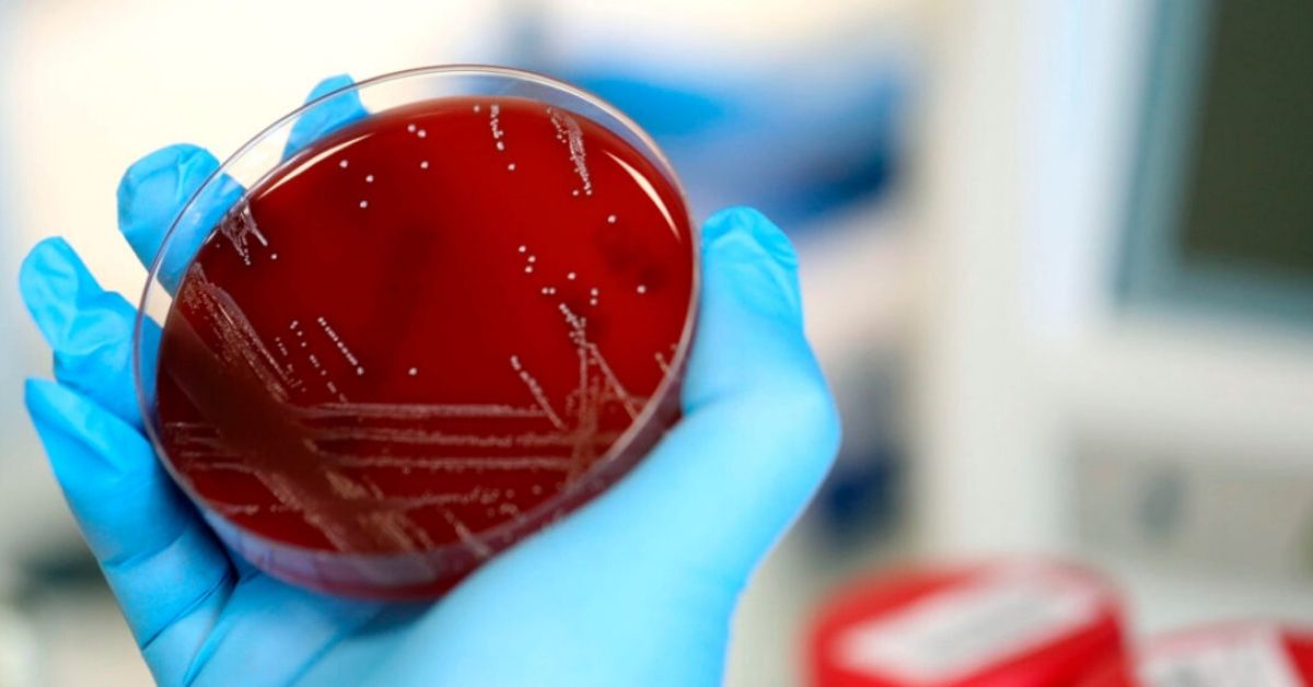OMS desmiente versiones de que el coronavirus salió de un laboratorio