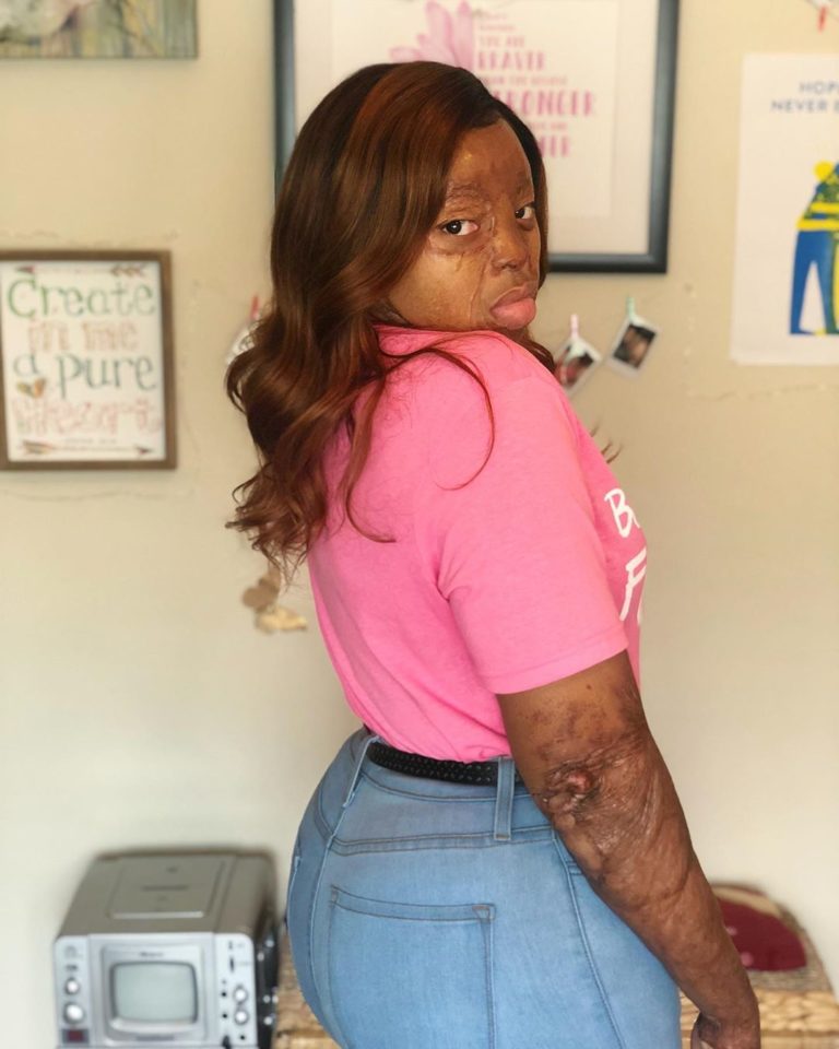 Kechi Okwuchi, sobrevivió a accidente aéreo y hoy triunfa como cantante